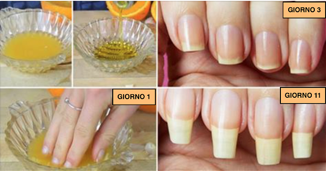 Ecco alcuni rimedi naturali per la crescita veloce delle unghie