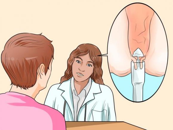 Ecco come sbarazzarsi delle emorroidi