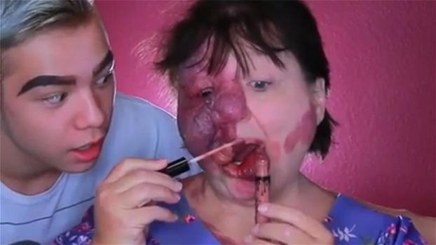 La donna soffre di una rara malattia: il figlio la trasforma con il make up in modo stupendo