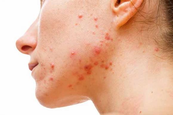 5 cose che ogni donna dovrebbe conoscere delle ovaie