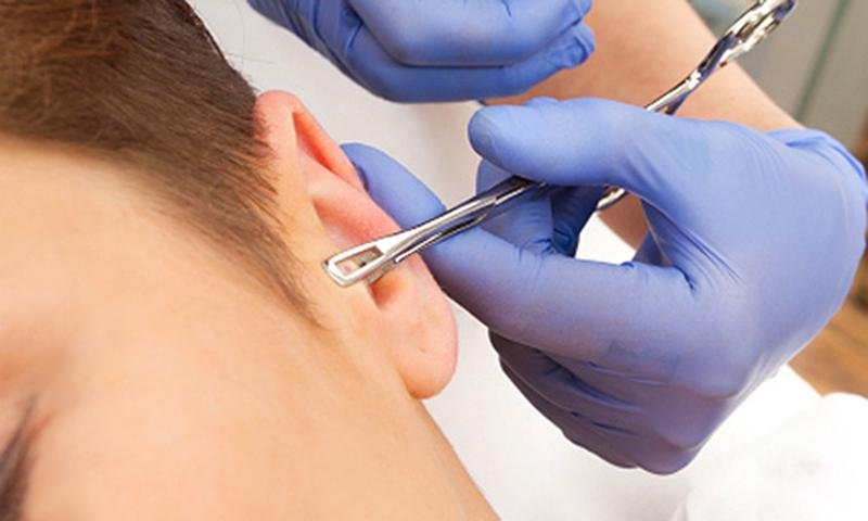 Solo un professionista potrà fare l'operazione del piercing all'orecchio senza rischi