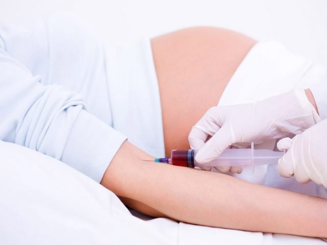 Per diagnosticare la sindrome di Crouzon è indispensabile sottoporsi ad un test prenatale