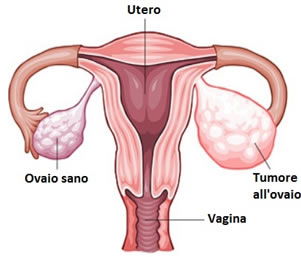 5 cose che ogni donna dovrebbe conoscere delle ovaie