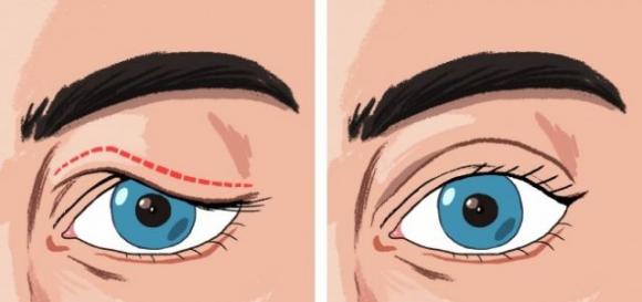 7 consigli per sbarazzarsi delle palpebre cadenti e ottenere uno sguardo splendido