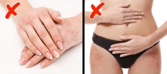 8 segnali che indicano che hai una carenza di vitamine nel corpo