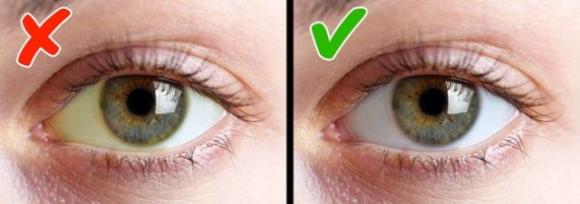 8 segnali che indicano che hai una carenza di vitamine nel corpo