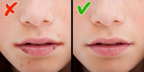 8 segnali che indicano che hai una carenza di vitamine nel corpo