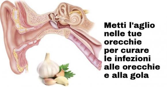 Metti l’aglio nelle tue orecchie per curare le infezioni alle orecchie e alla gola