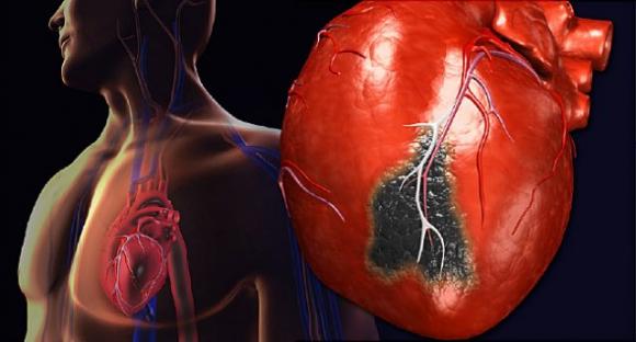 5 sintomi dell’infarto che tutte le donne tendono ad ignorare e dovrebbero riconoscere