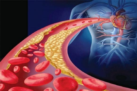 7 rimedi naturali per pulire le arterie e salvarti la vita