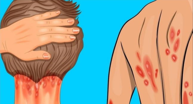 Cosa succede al tuo corpo se non hai abbastanza vitamina D