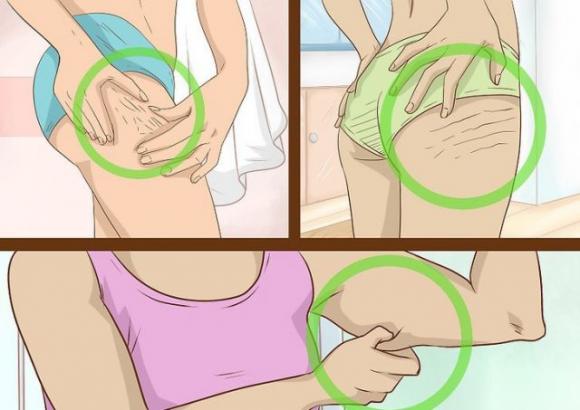 Rimuovi le cicatrici da qualsiasi parte del corpo in meno di un mese