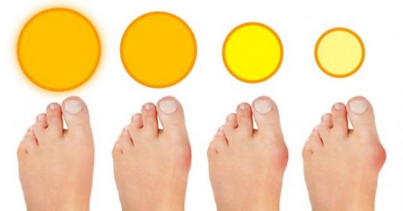 Cosa succede al tuo corpo se non hai abbastanza vitamina D