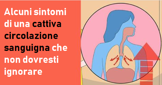 Alcuni sintomi di una cattiva circolazione sanguigna che non dovresti ignorare