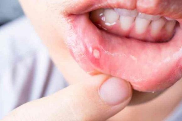 Gli usi e i benefici del bicarbonato di sodio che ogni donna dovrebbe conoscere