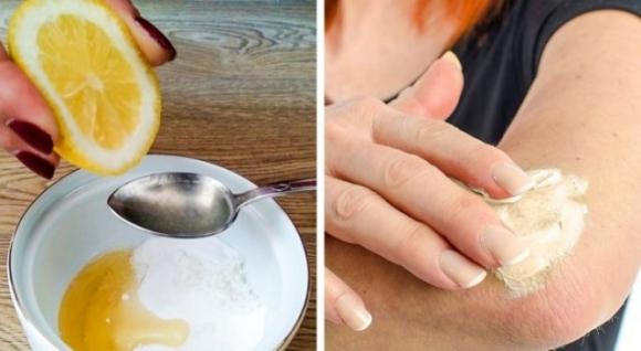 10 rimedi naturali per schiarire ginocchia e gomiti scuri