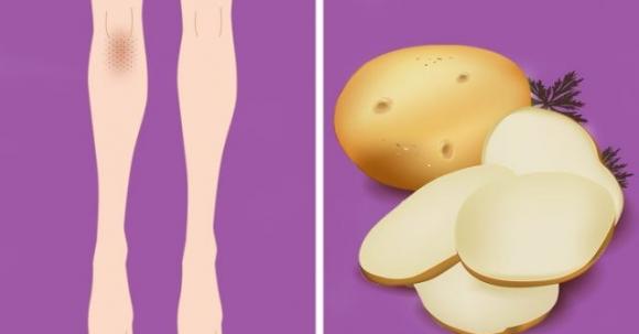 10 rimedi naturali per schiarire ginocchia e gomiti scuri