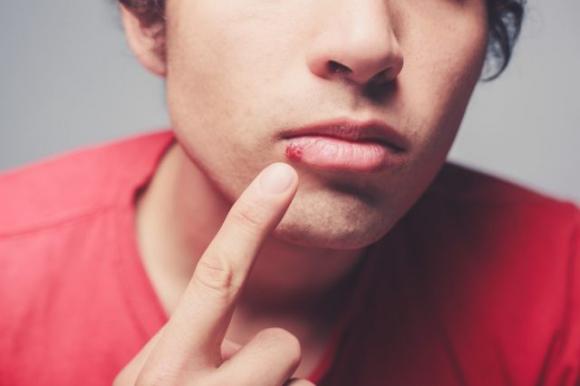11 cose insospettabili che il tuo viso può dire sulla tua salute