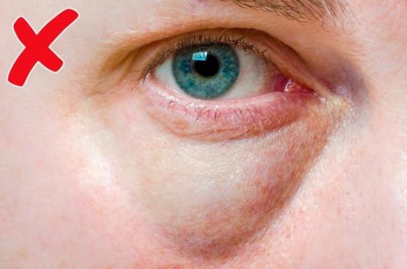 11 cose insospettabili che il tuo viso può dire sulla tua salute