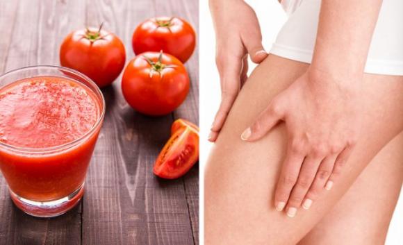10 rimedi naturali ed esercizi per sbarazzarsi delle vene varicose