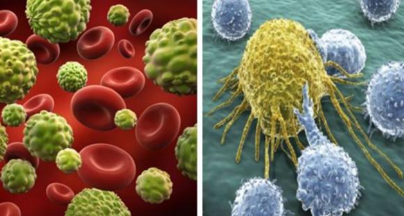 Cancro: la sanità non diffonde questa notizia perché la soluzione è troppo economica. La gente deve sapere!