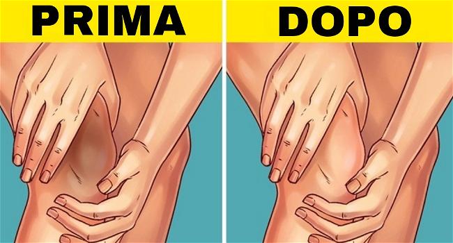 10 rimedi naturali per schiarire ginocchia e gomiti scuri
