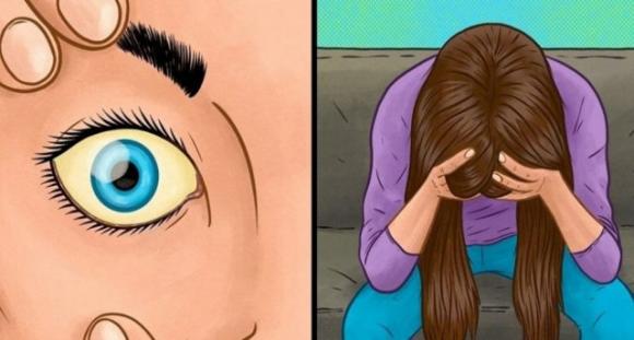 10 segni che indicano una carenza di vitamina B12