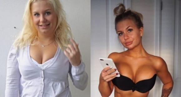 Una donna mostra la sua incredibile trasformazione dopo aver smesso di bere alcool