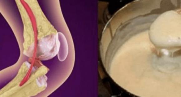 Questa ricetta sta diventando virale nel mondo! Guarisce l’artrosi del ginocchio e ricostruisce ossa e articolazioni