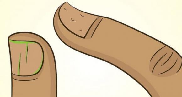 10 cose che le tue unghie possono rivelare sulla tua salute