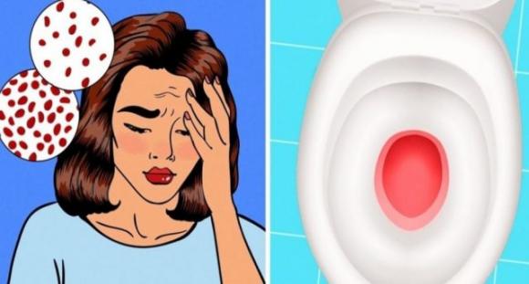 10 segni che indicano che il tuo corpo è carente di ferro