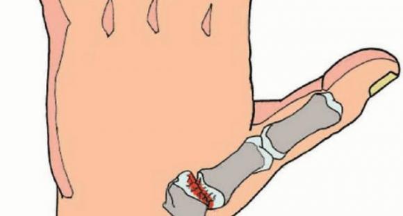 Se soffri di dolore al piede, al ginocchio o all’anca, ecco 6 esercizi per alleviarlo