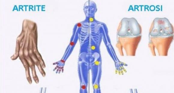 Se soffri di dolore al piede, al ginocchio o all’anca, ecco 6 esercizi per alleviarlo