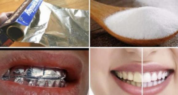 Avvolgi i denti con un foglio di alluminio e guarda cosa succede