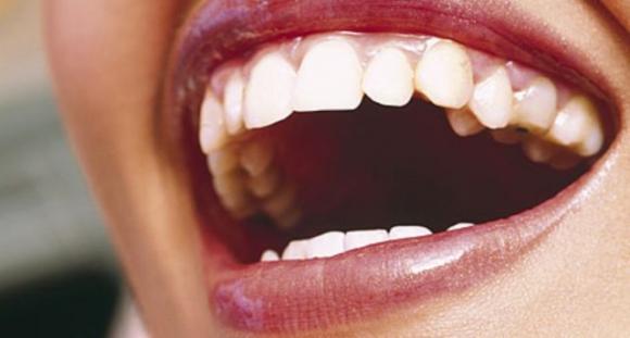 Avvolgi i denti con un foglio di alluminio e guarda cosa succede
