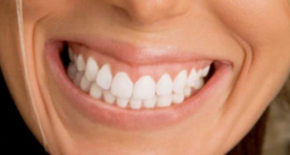 Avvolgi i denti con un foglio di alluminio e guarda cosa succede