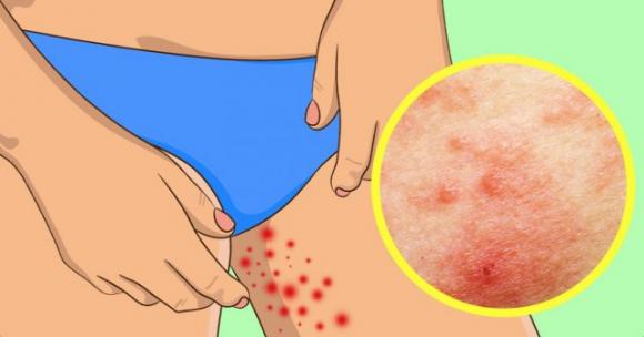 8 problemi che possiamo avere in estate e come risolverli