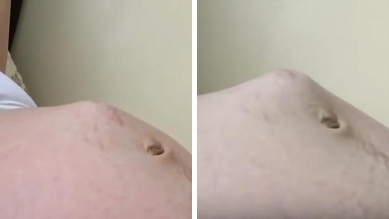 La mamma riprende i suoi gemellini a pochi giorni dal parto: “Cercano di uscire”