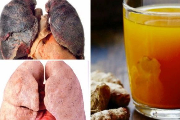 Ecco la miracolosa bevanda che pulisce i polmoni: chiunque abbia fumato o non abbia mai fumato deve provarla!