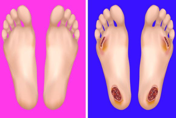 Dai un’occhiata ai tuoi piedi e scopri cosa dicono sulla tua salute