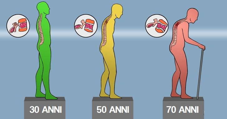 Le nostra ossa si indeboliscono col passare degli anni, ecco come mantenerle sane e forti