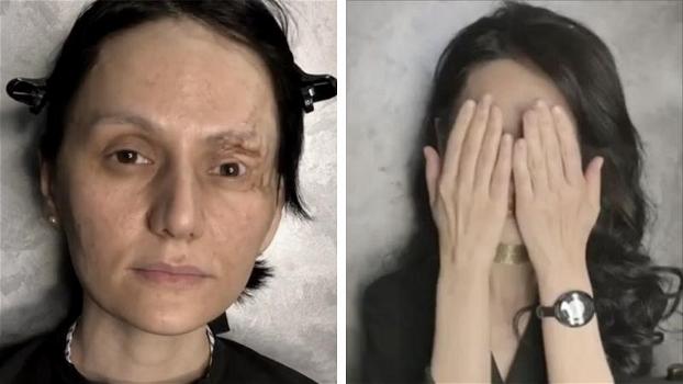 Dopo una brutta malattia, desidera rivedersi bella per una volta: una make up artist realizza il suo sogno