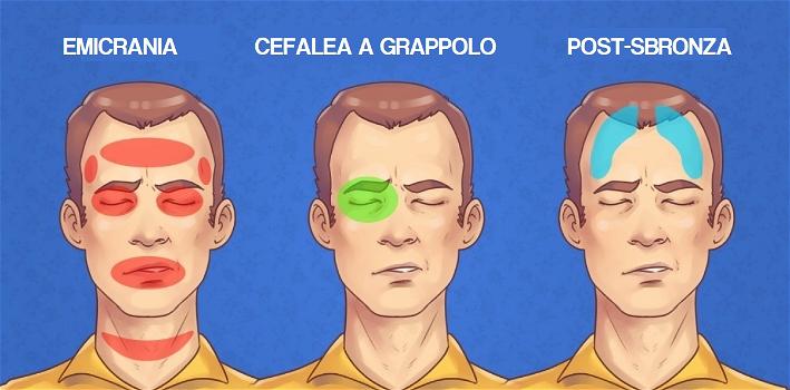 I 5 tipi di mal di testa più comuni e come curarli