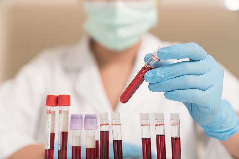 Le analisi del sangue sono fondamentali per la diagnosi