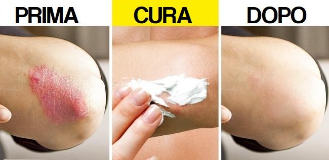 8 modi efficaci per combattere i problemi alla pelle più comuni