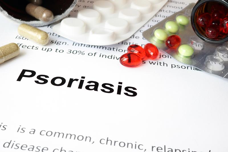 Psoriasi guttata: le cause, i sintomi e la cura