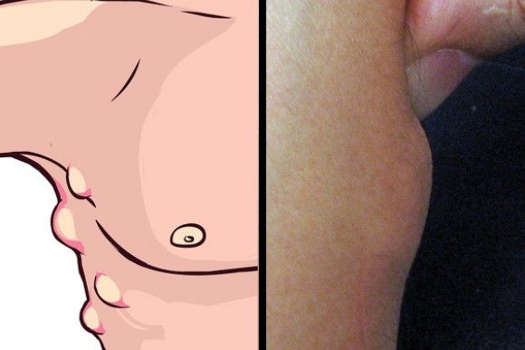 8 piccoli disturbi che possono essere davvero pericolosi per la tua salute