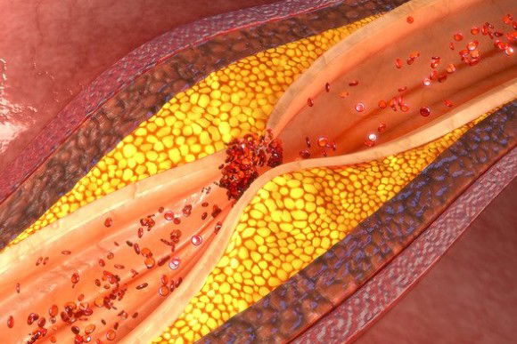Gombo: uno dei rimedi naturali più potenti contro il diabete, il colesterolo, l’affaticamento e non solo!
