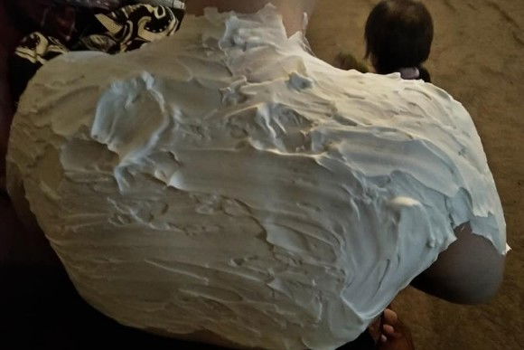 Una donna rivela la cura miracolosa di 30 minuti per le scottature solari e fa subito il giro del web!