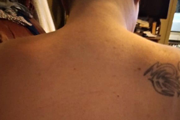 Una donna rivela la cura miracolosa di 30 minuti per le scottature solari e fa subito il giro del web!